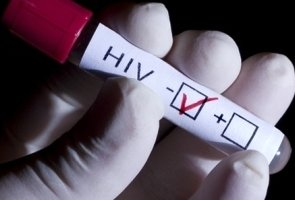 Hiv-testing