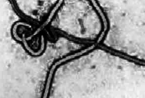 Ebola_virus_chehia