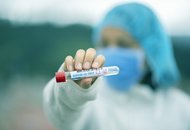 Чешские ученые разработали тест, позволяющий выявить риск тяжелой формы коронавируса